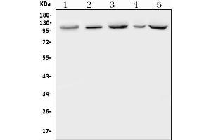 Western blot analysis of PKD2 using anti-PKD2 antibody (ABIN7602539).