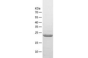 Western Blotting (WB) image for CINP (CINP) (AA 1-212) protein (His tag) (ABIN7288635) (CINP Protein (CINP) (AA 1-212) (His tag))