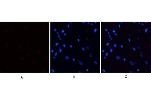 Immunofluorescence analysis of rat heart tissue. (PERK Antikörper  (pThr981))