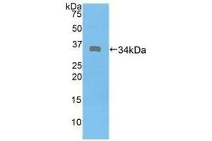 Detection of Recombinant DMD, Human using Polyclonal Antibody to Dystrophin (DMD) (Dystrophin Antikörper  (AA 3048-3328))