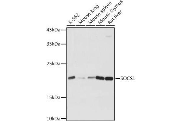 SOCS1 抗体  (AA 1-211)