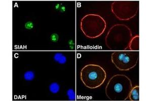 Immunofluorescence staining of SIAH2 on NIH : OVCAR-3 with SIAH2 monoclonal antibody, clone 24E6H3 . (SIAH2 Antikörper  (AA 1-100))