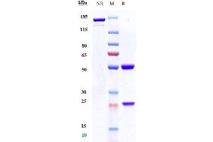 Anti-CD19 Reference Antibody (tafasitamab) on SDS-PAGE under reducing (R) condition.