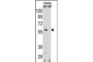 SD5 Antibody (Center) (ABIN1881816 and ABIN2838794) pre-incubated without(lane 1) and with(lane 2) blocking peptide in Hela cell line lysate. (SMAD5 Antikörper  (AA 241-269))
