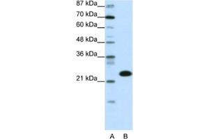 Western Blotting (WB) image for anti-TATA Box Binding Protein Associated Factor 11 (TAF11) antibody (ABIN2460381) (TAF11 Antikörper)