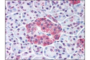 Image no. 1 for anti-Wingless-Type MMTV Integration Site Family, Member 10A (WNT10A) (Internal Region) antibody (ABIN302587) (WNT10A Antikörper  (Internal Region))