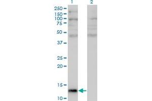 Western Blot analysis of ANG expression in transfected 293T cell line by ANG monoclonal antibody (M05), clone 2A7. (ANG Antikörper  (AA 25-147))