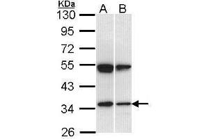 WB Image Sample (30 ug of whole cell lysate) A: Hep G2 , B: Raji 10% SDS PAGE antibody diluted at 1:1000 (SH3GL1 Antikörper  (Center))