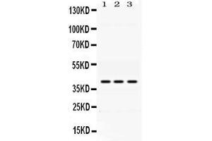 Western blot analysis of ADH1A using anti- ADH1A antibody . (ADH1A Antikörper  (AA 213-375))