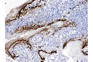 Immunohistochemistry (IHC) image for anti-Chromosome 4 Open Reading Frame 7 (C4orf7) (AA 18-51), (Middle Region) antibody (ABIN5518833)