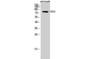 Western Blotting (WB) image for anti-Platelet/endothelial Cell Adhesion Molecule (PECAM1) (Thr224) antibody (ABIN3179924) (CD31 Antikörper  (Thr224))