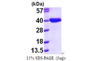 Aminoadipate-Semialdehyde Dehydrogenase-phosphopantetheinyl Transferase (AASDHPPT) (AA 14-309) protein (His tag)