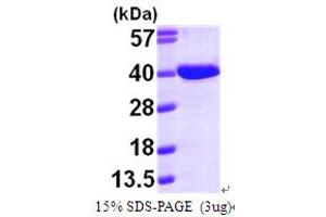 SDS-PAGE (SDS) image for Aminoadipate-Semialdehyde Dehydrogenase-phosphopantetheinyl Transferase (AASDHPPT) (AA 14-309) protein (His tag) (ABIN667231)