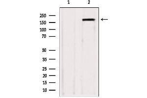 Western blot analysis of extracts from various samples, using ZCCHC11 antibody. (ZCCHC11 Antikörper  (Internal Region))