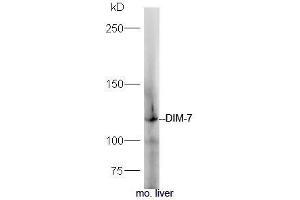 Mouse liver lysates probed with Rabbit Anti-DIM 7 Polyclonal Antibody, Unconjugated (ABIN2173613) at 1:300 overnight at 4˚C. (Moleskin Antikörper  (AA 401-500))