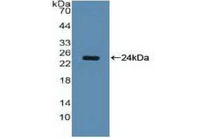 Detection of Recombinant NCL, Human using Polyclonal Antibody to Nucleolin (NCL) (Nucleolin Antikörper  (AA 388-569))