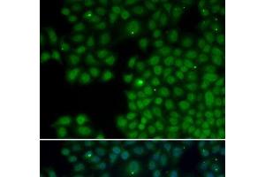 Immunofluorescence analysis of HeLa cells using NUDT6 Polyclonal Antibody