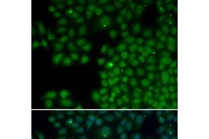 Immunofluorescence analysis of HeLa cells using NUDT6 Polyclonal Antibody (NUDT6 Antikörper)