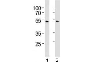 Western blot analysis of lysate from 1) HepG2 and 2) HUVEC cell line using SUV39H2 antibody at 1:1000.