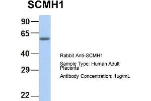 Host: Rabbit Target Name: CHAD Sample Type: Human Adult Placenta Antibody Dilution: 1. (SCMH1 Antikörper  (Middle Region))