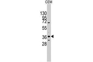 Western blot analysis of PITX2 polyclonal antibody  in CEM cell line lysates (35 ug/lane). (PITX2 Antikörper  (C-Term))
