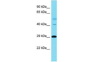 Host:  Rabbit  Target Name:  RNF149  Sample Type:  Lung Tumor lysates  Antibody Dilution:  1. (RNF149 Antikörper  (C-Term))