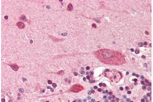 Human Brain, Cerebellum (formalin-fixed, paraffin-embedded) stained with PDPN antibody ABIN364350 at 5 ug/ml followed by biotinylated anti-mouse IgG secondary antibody ABIN481714, alkaline phosphatase-streptavidin and chromogen. (Podoplanin Antikörper  (AA 1-206))