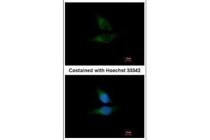 ICC/IF Image Immunofluorescence analysis of methanol-fixed HeLa, using ORP1, antibody at 1:200 dilution. (OSBPL1A Antikörper  (C-Term))