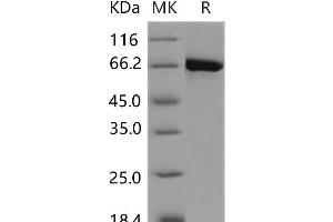 Western Blotting (WB) image for EPH Receptor A4 (EPHA4) (AA 570-986) (Active) protein (GST tag,His tag) (ABIN7317076) (EPH Receptor A4 Protein (EPHA4) (AA 570-986) (GST tag,His tag))