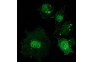Anti-CTNNB1 mouse monoclonal antibody (ABIN2454167) immunofluorescent staining of COS7 cells transiently transfected by pCMV6-ENTRY CTNNB1 (RC208947). (CTNNB1 Antikörper)