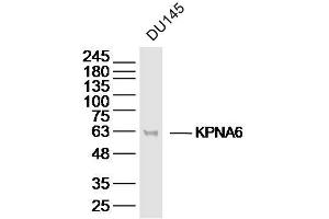 DU145 lysates probed with KPNA6 Polyclonal Antibody, Unconjugated  at 1:300 dilution and 4˚C overnight incubation. (KPNA6 Antikörper  (AA 101-200))
