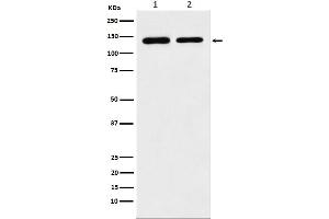 Western blot analysis of SA2 expression in (1) K562 cell lysate, (2) Raw264.