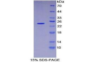 SDS-PAGE (SDS) image for Dishevelled Segment Polarity Protein 1 (DVL1) (AA 150-332) protein (His tag) (ABIN1879091)