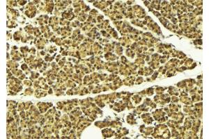 ABIN6274105 at 1/100 staining Mouse pancreas tissue by IHC-P. (AKAP8 Antikörper  (Internal Region))