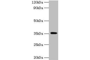 Western blot All lanes: DOK5 antibody at 2 μg/mL + Mouse kidney tissue Secondary Goat polyclonal to rabbit IgG at 1/15000 dilution Predicted band size: 36, 23 kDa Observed band size: 36 kDa (DOK5 Antikörper  (AA 1-198))