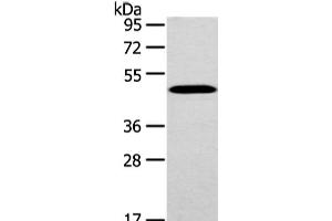 Western Blot analysis of Mouse brain tissue using WWOX Polyclonal Antibody at dilution of 1/200