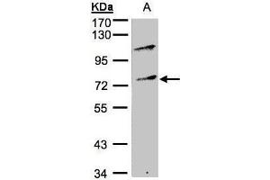 WB Image Sample(30 ug whole cell lysate) A:Raji , 10% SDS PAGE antibody diluted at 1:500 (MZF1 Antikörper)