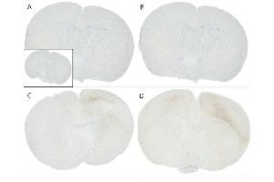 Immunohistochemistry analysis using Mouse Anti-Alpha Synuclein pSer129 Monoclonal Antibody, Clone J18 (ABIN6932870). (SNCA Antikörper  (pSer129) (APC))