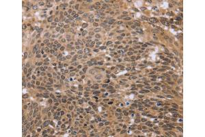 Immunohistochemistry (IHC) image for anti-Excision Repair Cross-Complementing Rodent Repair Deficiency, Complementation Group 6-Like (ERCC6L) antibody (ABIN2430026) (ERCC6L Antikörper)