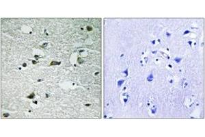 Immunohistochemistry analysis of paraffin-embedded human brain, using CK-1 gamma1/2/3 (Phospho-Tyr263) Antibody. (CK-1 gamma1/2/3 (AA 229-278), (pTyr263) Antikörper)