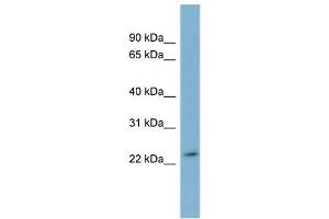 WB Suggested Anti-DUXA Antibody Titration:  0. (DUXA Antikörper  (Middle Region))