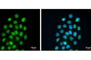 ICC/IF Image p63 antibody [N2C1], Internal detects p63 protein at nucleus by immunofluorescent analysis. (p63 Antikörper)