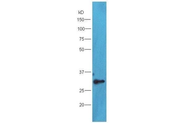 TXNDC9 antibody  (AA 182-226)