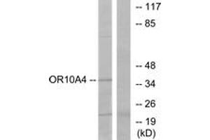 Western blot analysis of extracts from COLO cells, using OR10A4 Antibody. (OR10A4 Antikörper  (AA 261-310))