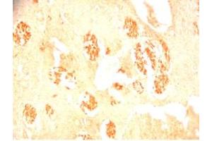 Rat brain tissue was stained by Rabbit Anti-Metasin (1-25) / KISS-1 (68-92) (Human) Serum (KISS1 Antikörper  (AA 1-25, AA 68-92))