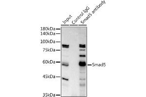 Immunoprecipitation analysis of 300 μg extracts of K-562 cells using 3 μg Smad5 antibody (ABIN7270354).