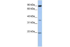 WB Suggested Anti-C13orf7  Antibody Titration: 0. (RNF219 Antikörper  (N-Term))