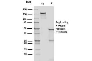 SDS-PAGE Analysis Purified CD209 Mouse Monoclonal Antibody (rC209/1781). (Rekombinanter DC-SIGN/CD209 Antikörper)