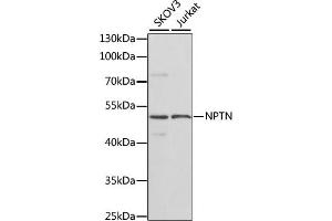 Western blot analysis of extracts of various cell lines, using NPTN antibody (ABIN6129584, ABIN6144789, ABIN6144790 and ABIN6223981) at 1:1000 dilution. (NPTN Antikörper  (AA 29-200))