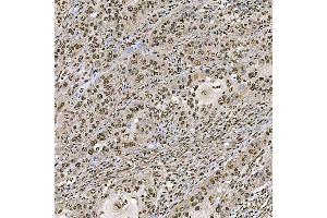 IHC analysis of SART1 using anti-SART1 antibody (ABIN7599884). (SART1 Antikörper  (AA 125-800))